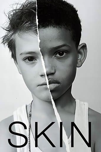 Skin poster - Find streaming availability