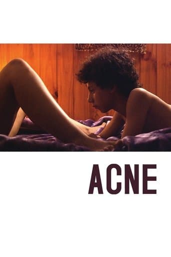 Acne poster - Find streaming availability