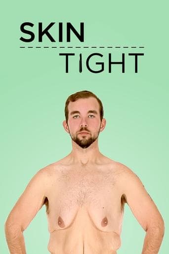 Skin Tight poster - Find streaming availability